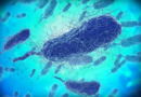 ‘Flesh-Eating’ Bacteria Kills 15: Weird News & Oddities – Patch