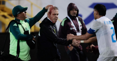 Mexico coach hit in head by beer can in Honduras