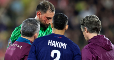 PSG keeper Donnarumma injured by cleat to face