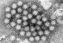 Norovirus cases are surging around the US and 40% above highs for this time of year