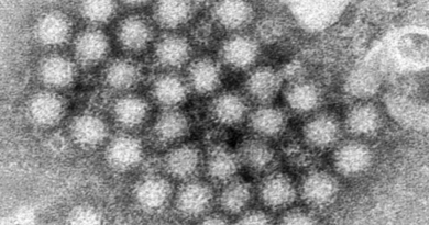 Norovirus cases are surging around the US and 40% above highs for this time of year