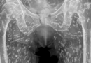 Horrific x-ray shows man 'full of zombie tapeworms' after making one kitchen vital error – The Mirror